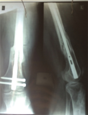 TMT-5-184-F6.jpg