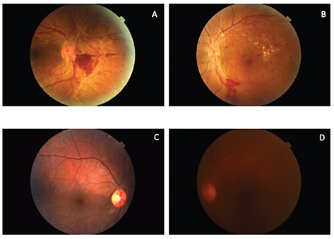 Fig 3