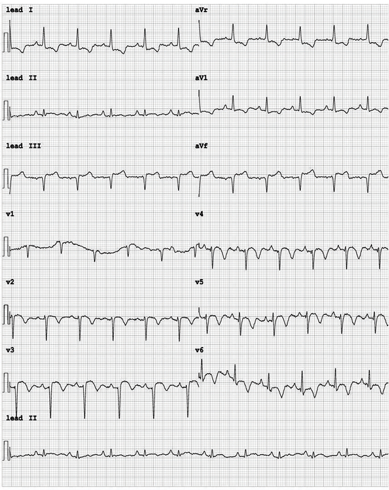 Click to Enlarge View Fig 3
